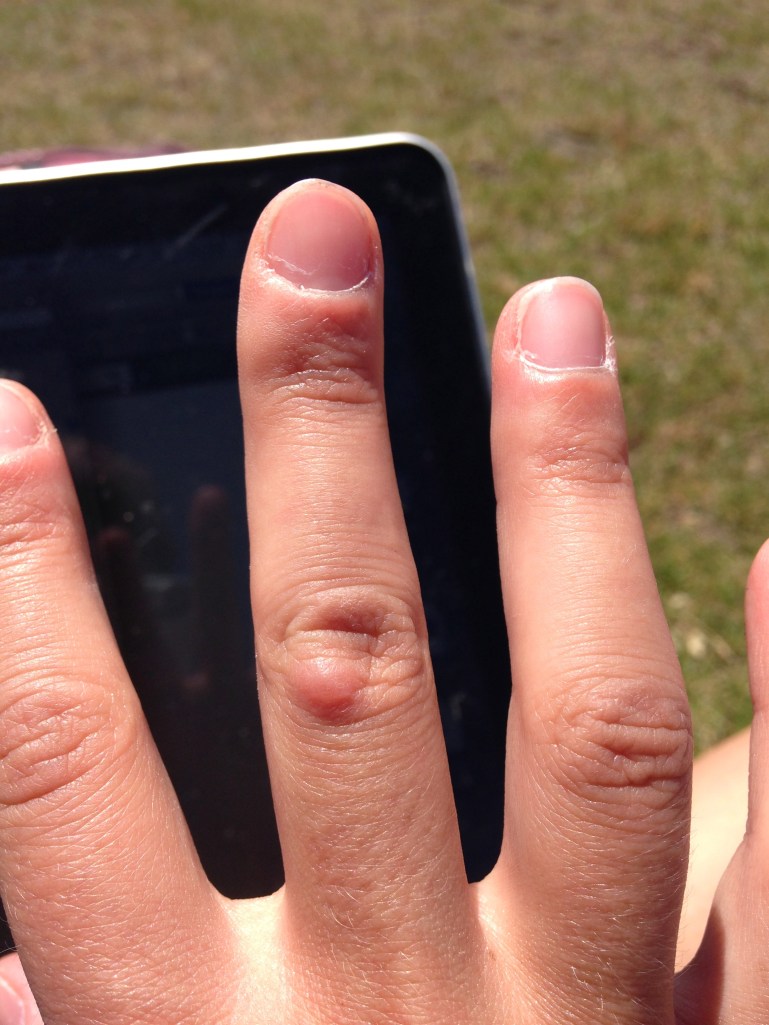 I may have exaggerated the similarities